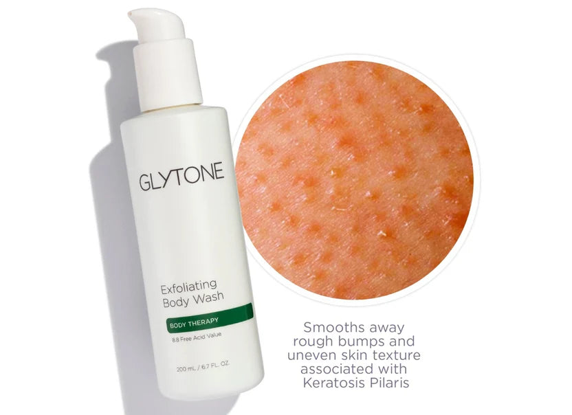 Glytone Body Therapy Exfoliating Body Wash (6.7 oz)