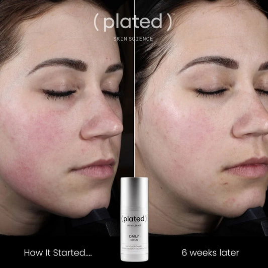 Plated Daily Serum