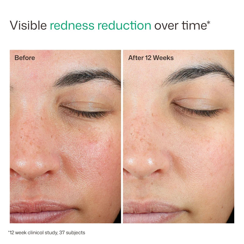EltaMd UV SKin Recovery Non-Tinted