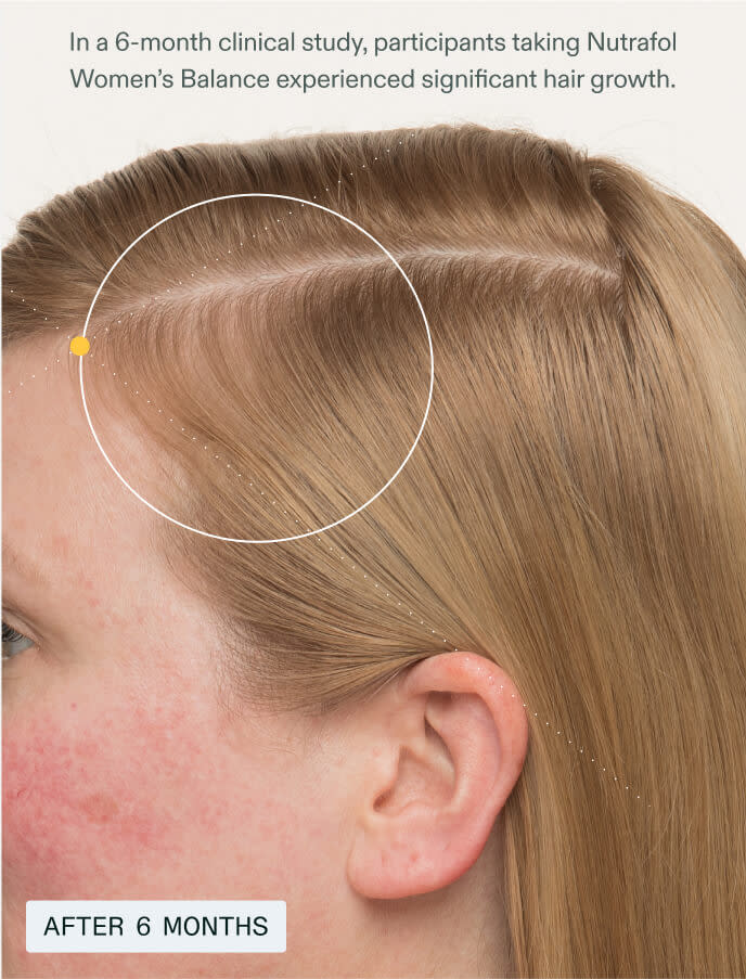 Nutrafol Women's Balance Hair Growth Pack 3-month Supply