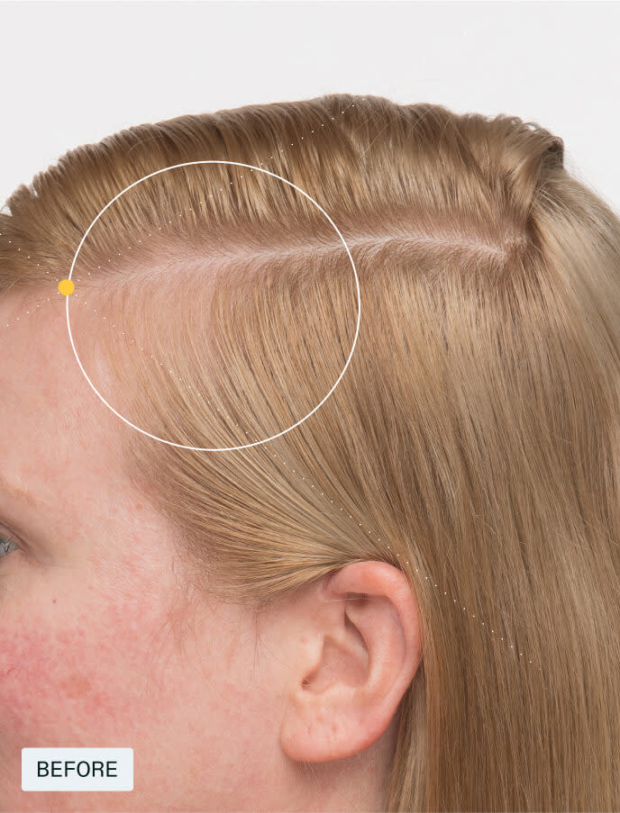 Nutrafol Women's Balance Hair Growth Pack 3-month Supply